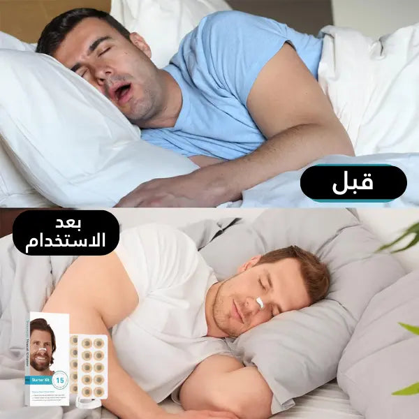 مُوسّع التنفّس الأنفي – الحلّ الذكي للتنفس السلس ونوم أعمق بلا شخير